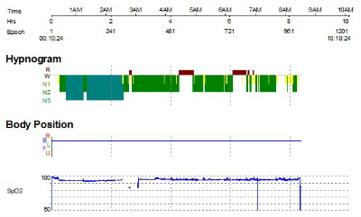 Sleep report