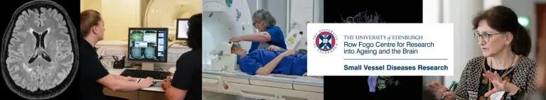 Collage of brain-related imagery, brain scan, people in MRI machine, Joanna Wardlaw teaching