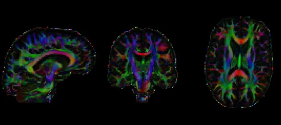 Black background, three colourful brain scans