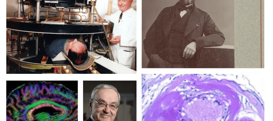 Collage of people and brain scans
