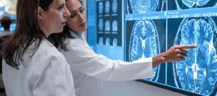 LACI-3 Researchers examining brain scan