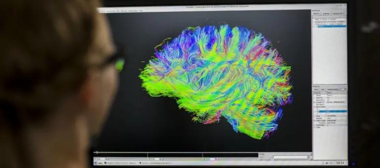 Image of Brain