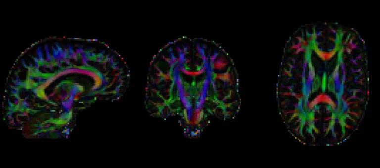 Black background, three colourful brain scans