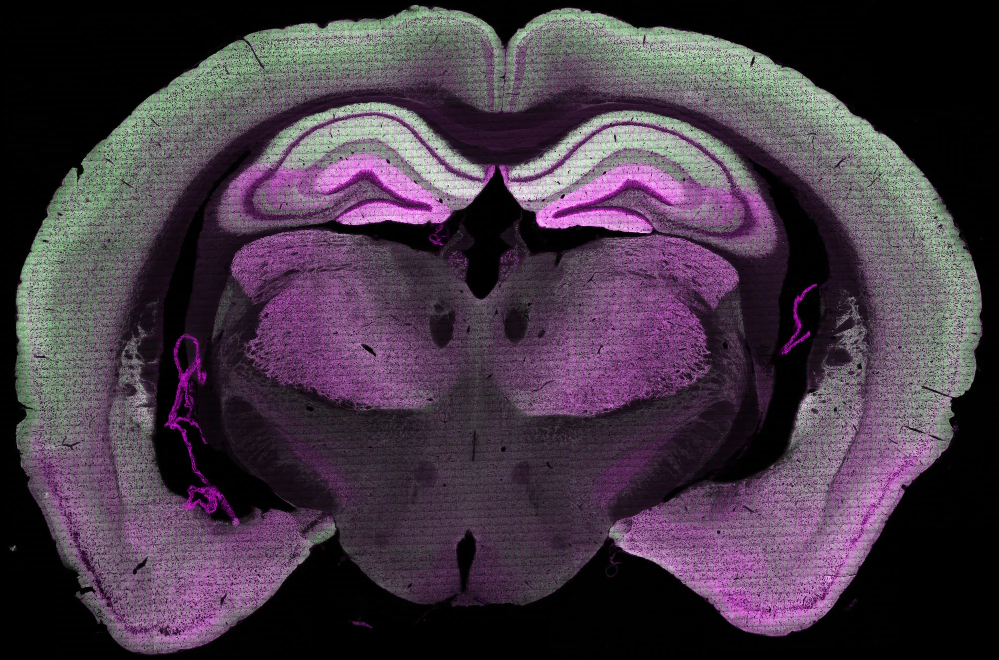 Mouse brain segment showing distribution of two synapse proteins