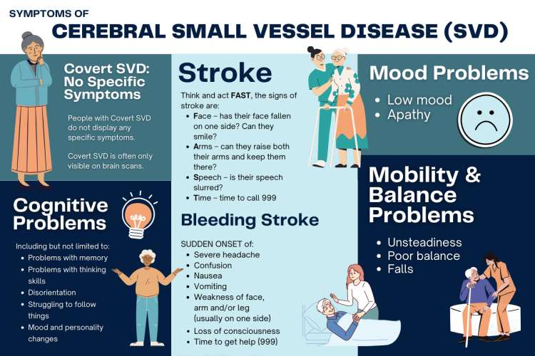 Small vessel disease (SVD) refers to pathological processes affecting the small arteries, arterioles, capillaries, and venules, leading to impaired blood flow and tissue damage. It is a systemic condition impacting organs with rich microvascular networks, especially the brain, heart, kidneys, and retina.