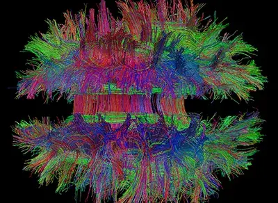 neuroimaging