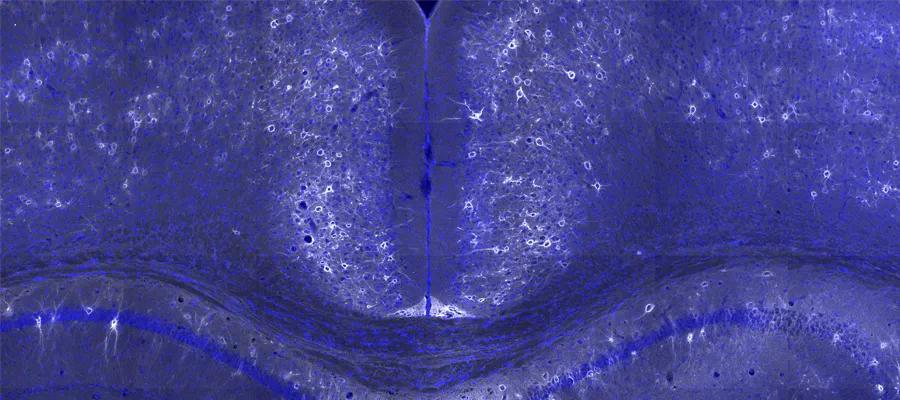 rodent brain showing perineuronal nets around neurone
