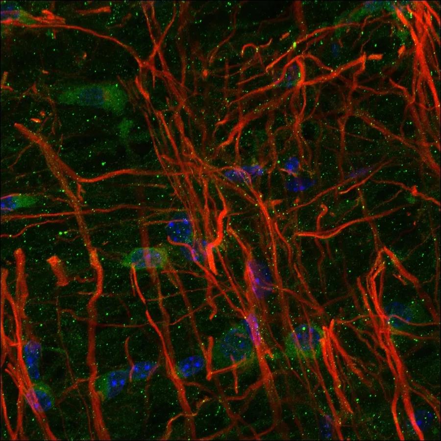 Spinal cord image showing neuronal and astrocyte cells