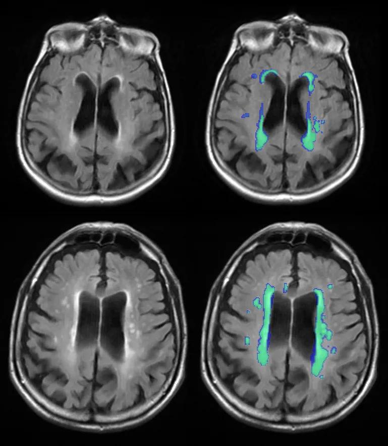 Brain square