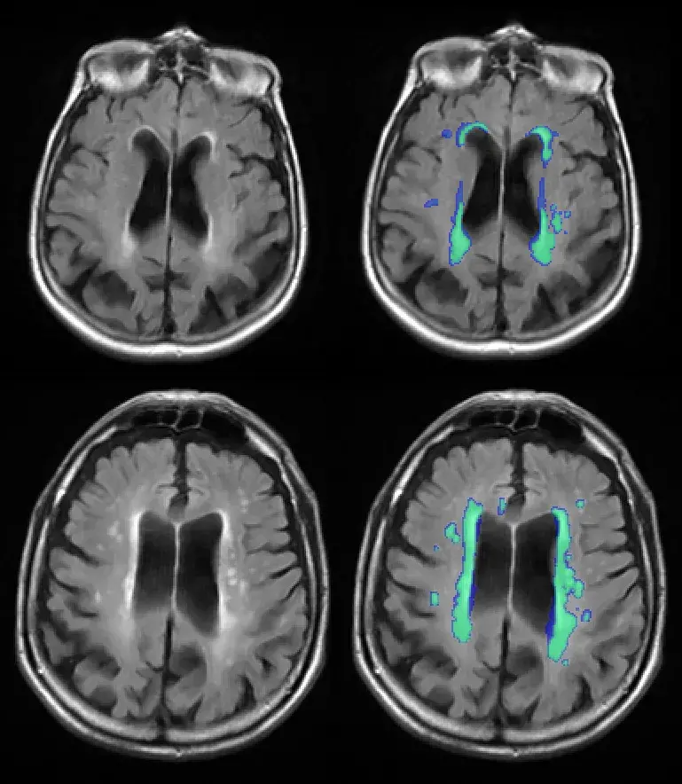 Brain square