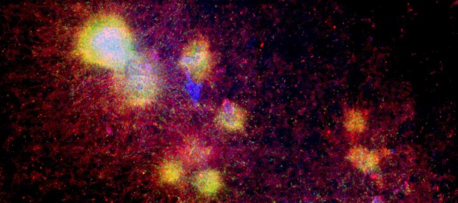 Neural stem cells in culture marked with green fluorescent protein