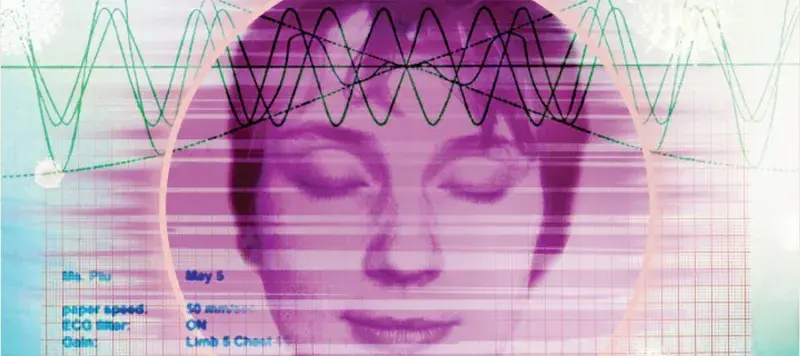 Illustration representing medically unexplained symptoms