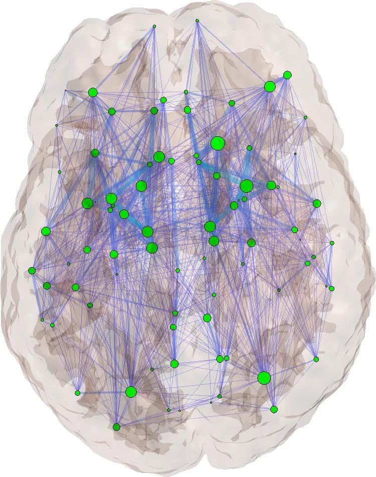 brain network