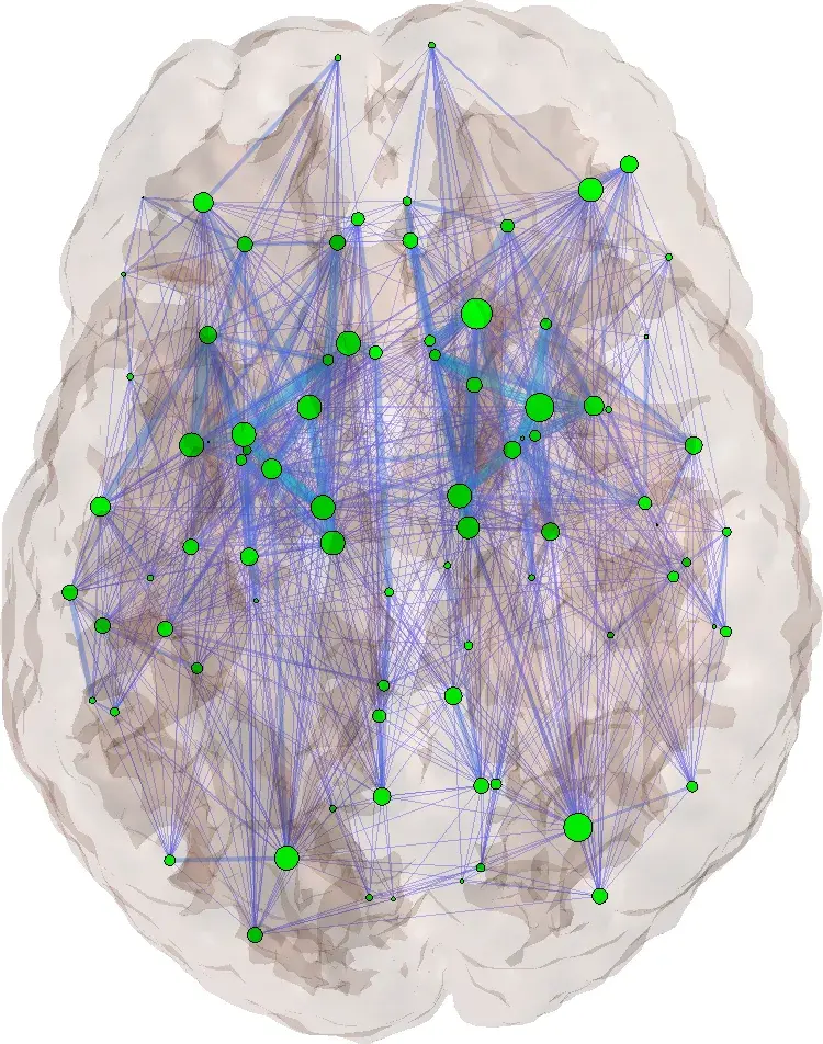 brain network