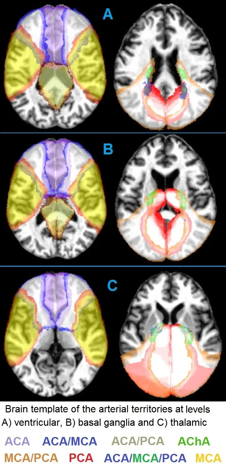 Brain line