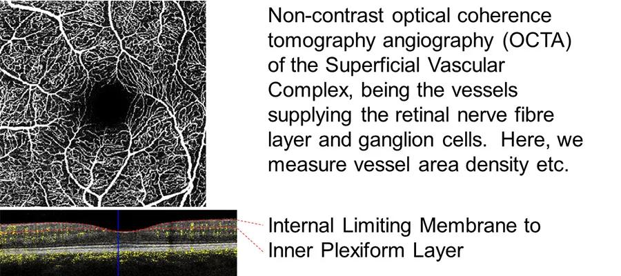 Retinal Network Image