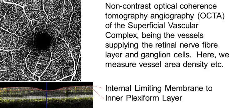 Retinal Network Image