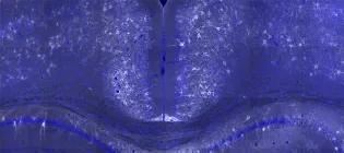 rodent brain showing perineuronal nets around neurone